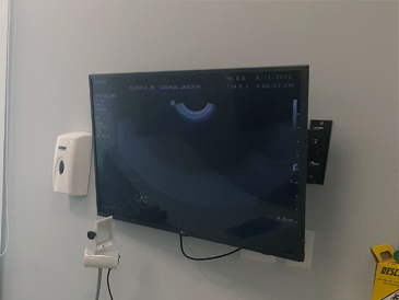 tv ultrassom